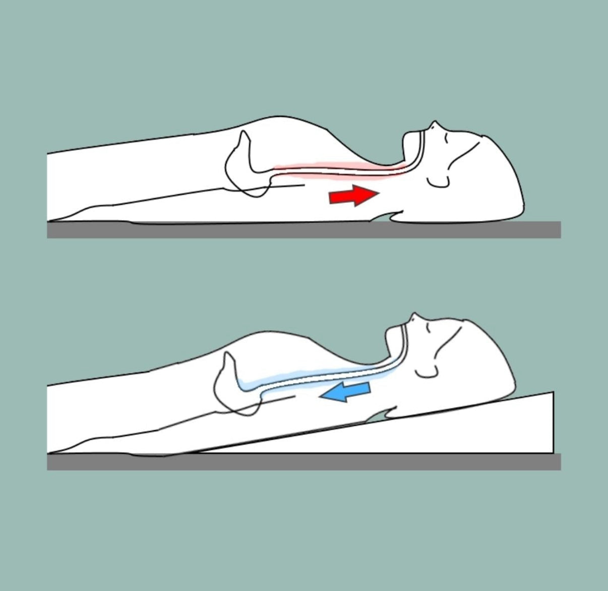 Acid Reflux Wedge Pillow